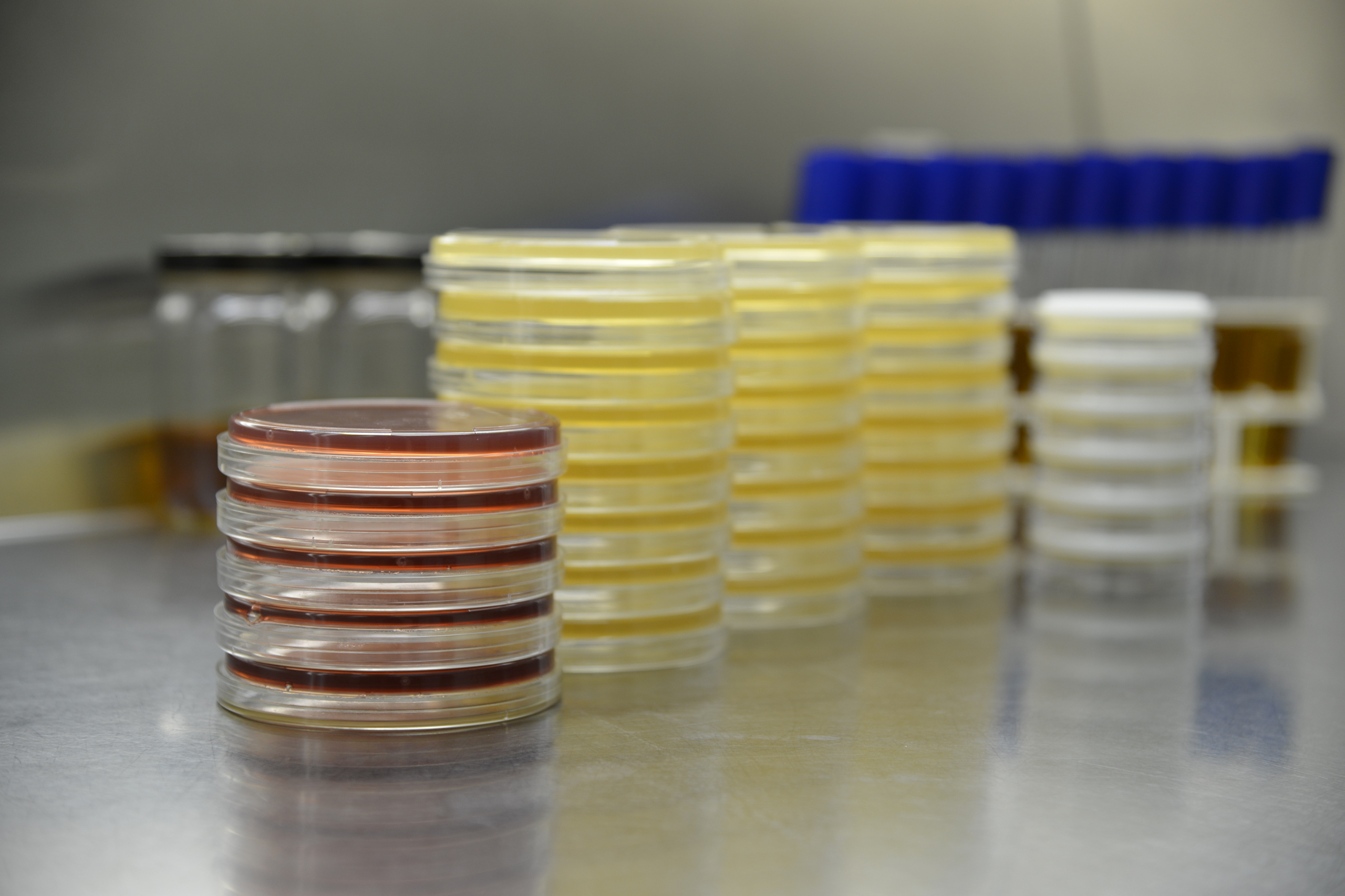 Tissue Testing Laboratory Services for Tissue Banks and Biologics